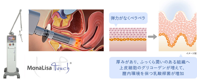 モナリザタッチ まるはし女性応援クリニック